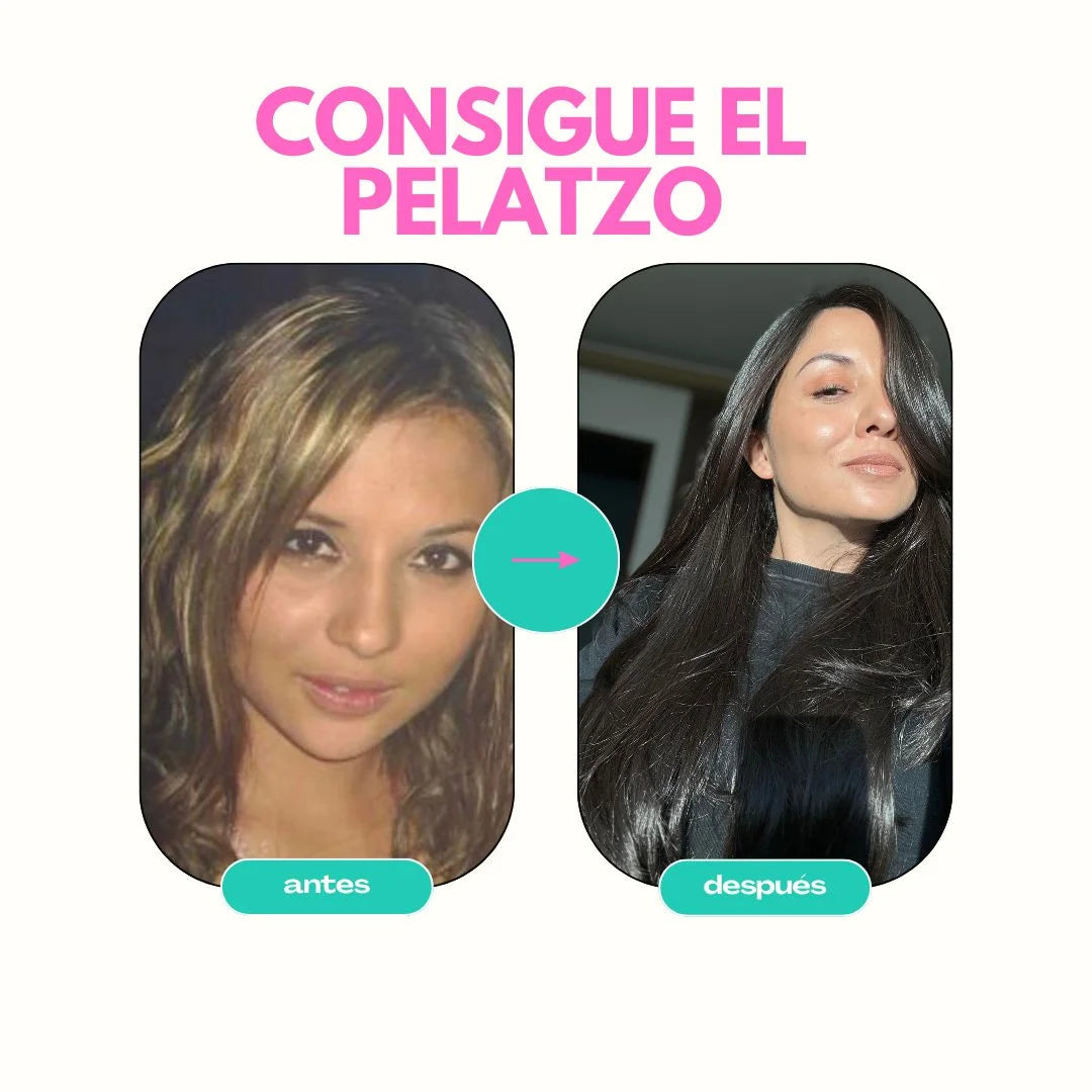 Comparación antes y después del tratamiento capilar Kit Top Melena para crecimiento del cabello"
"Kit completo de cuidad