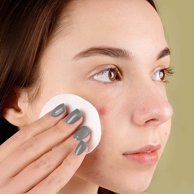 Control de grasa facial y acné: rutina sugerida