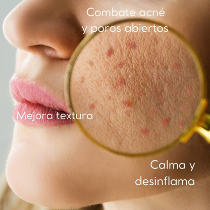 crema para piel acnéinca acence blemish
